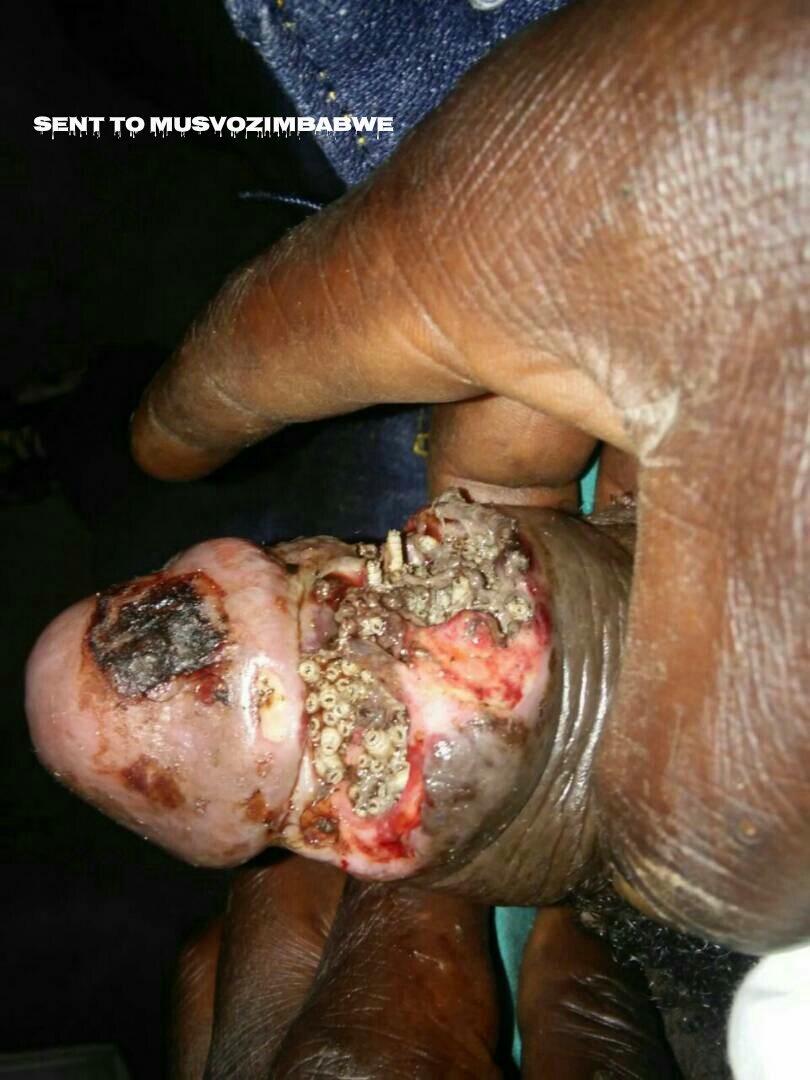 Whatsapp Penis Whatsapp Penis